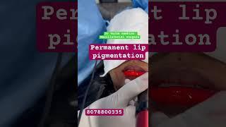 Permanent lip pigmentation #celebritysurgeon #beforeandafterresults DR VARUN NAMBIAR