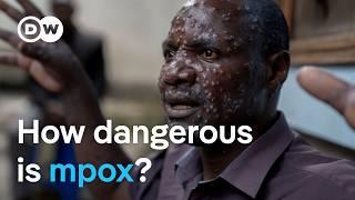 New mpox virus Why is it spreading so quickly?  DW News