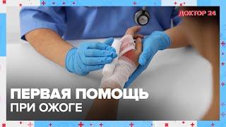 Первая помощь при ОЖОГЕ  Доктор 24