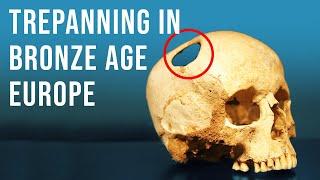 Are These Skulls Evidence of Bronze Age Brain Surgery?