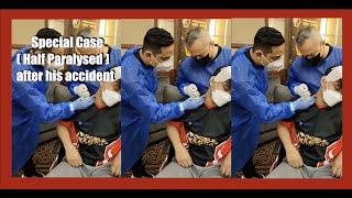 Special Case Half Paralysed after his accident - Chris Leong  MostAmazingTop10   TOP 3 Most