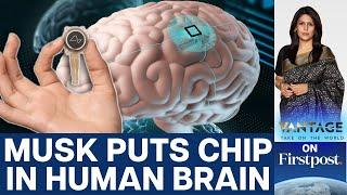 Elon Musks Neuralink puts First Brain Chip in a Human  Vantage with Palki Sharma