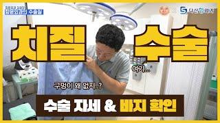 ※당황주의※ 치질 수술할때 옷 안입어?feat. 자세&바지 확인