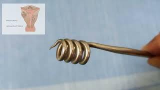 Gynecology Myoma screw Myomectomy instrument real Leiomyoma Fibroid uterus surgery Uses
