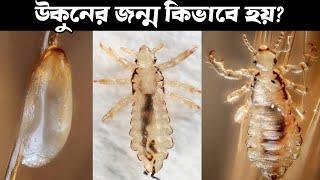 উকুনের জীবনচক্র এবং মাথায় এরা কিভাবে আসে  Lice lifecycle in detail  Funny facts #viral