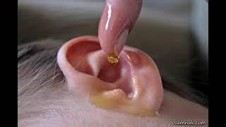 علت گوش دردی نوزادان و کودکان  روش  درمان گوش دردی  علایم گوش دردی کودکان و نوزادان
