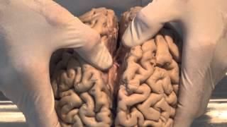 Introduction Neuroanatomy Video Lab - Brain Dissections