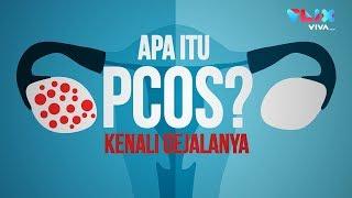 Bikin Wanita Susah Hamil Kenali Gejala PCOS