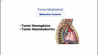 ESPECIALIDADES I Tumores mediastinales