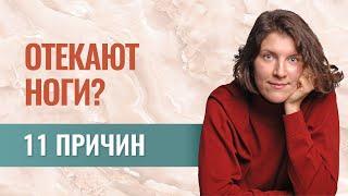 Отеки ног 11 причин. Как самостоятельно разобраться