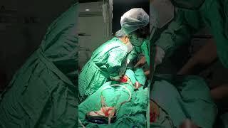 Caesarean delivery of a healthy baby - PART 2 #baby #doctor