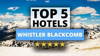 Top 5 Hotels in Whistler Blackcomb Canada Best Hotel Recommendations