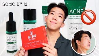 Never again SOMEBYMI Acne Review  WORST Skin reaction • AHA BHA PHA