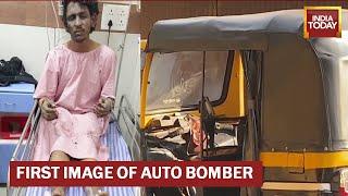 First Images Of Auto Bomber Mohammed Shariq A Terror Accused On The Run  Mangaluru Auto Blast