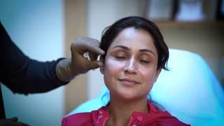 Cheek Fillers in Chandigarh- Cheek and Jawline shaping with Fillers for actress Jassi Kaur