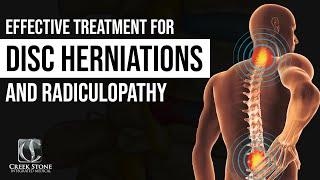 Effective Treatment for Disc Herniations & Radiculopathy