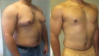 how to get rid of gynecomastia in teenagers now