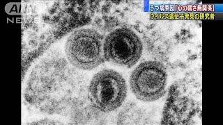 うつ病は「心の弱さからくる病気ではない」専門家2020年10月3日