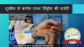 कलाई की दबी हुई नस को दूरबीन से ठीक कर सकते है Endoscopic Carpal Tunnel release  Dr Prathmesh Jain