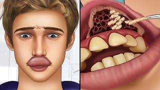 ASMR Remove botfly maggots found inside mountaineers mouth  Dental care animation