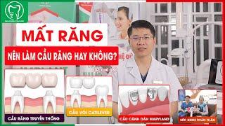 Mất răng thì có nên làm cầu răng hay không?