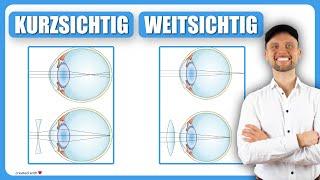 Kurzsichtig Myopie und Weitsichtig Hyperopie - Optik Auge