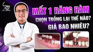 Nhổ mất răng hàm thì phải trồng lại răng giả như thế nào? bật mí phường pháp  mới giúp...