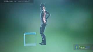 Radiculopathy. Symptoms