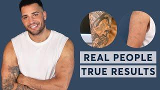 Laser Tattoo Removal    Real People True Results 2023