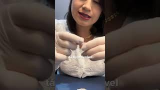 Meu aparelho Ortodôntico está machucando. O que fazer? Sua Dentista Ianara Pinho explica #dentista