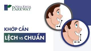 KHỚP CẮN LỆCH  KHỚP CẮN CHUẨN  NIỀNG RĂNG VÀ CÂU CHUYỆN KHỚP CẮN