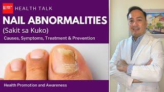 What causes Nail abnormalities?