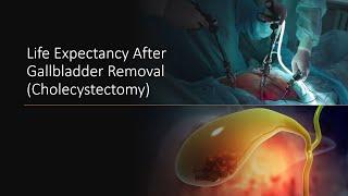 Life Expectancy After Gallbladder Removal Cholecystectomy