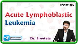 15. Acute Lymphoblastic Leukemia ALL  USMLE Step 1 Pathology