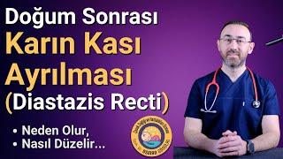 Diastazis Recti Nedir?