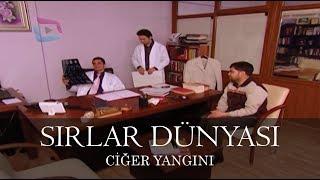 Sırlar Dünyası - CİĞER YANGINI