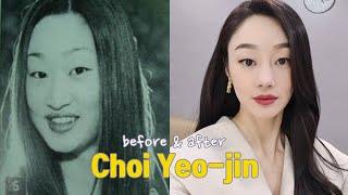 Choi Yeo-jin before and after
