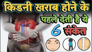 किडनी खराब होने के 6 लक्षण और इलाज  6 Warning signs of kidney damage 