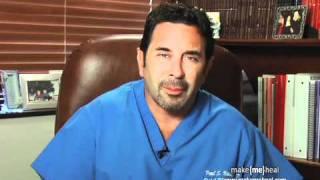 Dr. Paul Nassif discusses the side effects of Dysport injections