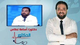 الدكتور  الدعامة الهيدروليكية لعلاج الضعف الجنسي مع دكتور أسامة غطاس