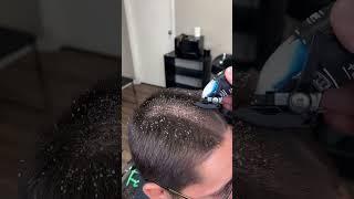 BARBER CUTS OFF LICE MUST WATCH