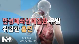 흡연이 COPD를 유발하는 기전 - 717회19.12.04 몰라서 더 무섭다 COPD만성폐쇄성폐질환