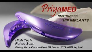 PriyaMED presents... Meet the CURVE - Custom 3D Printed Titanium Iliac Hip Implants.