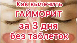 Как вылечить гайморит в домашних условиях ПРОВЕРЕНО НА СЕБЕ