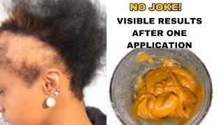 Using this treatment for hair growth will be one of the best decisions of your life April 21 2024