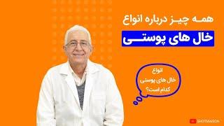 همه چیز درباره انواع خال های پوستی