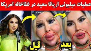 چهره جدیدی آریانا سعید بعد از جراحی زیبایی در شفاخانه آمریکا  چهره زیبا آریانا سعید