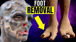 Black Alien Project Disturbing Foot Modification This Will Ruin His Life