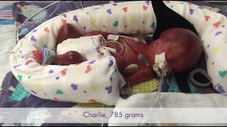 The Gardner Story - Baby Charlie  Born at 25 Weeks