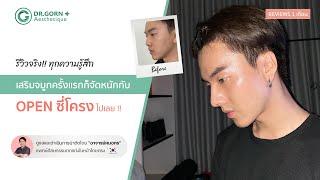 เสริมจมูกครั้งแรกในชีวิต ด้วยกระดูกอ่อนซี่โครง Open Rib cartilage l Dr.Gorn Aesthetique